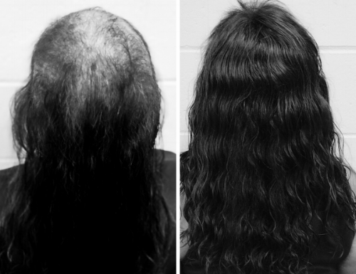 Client photo