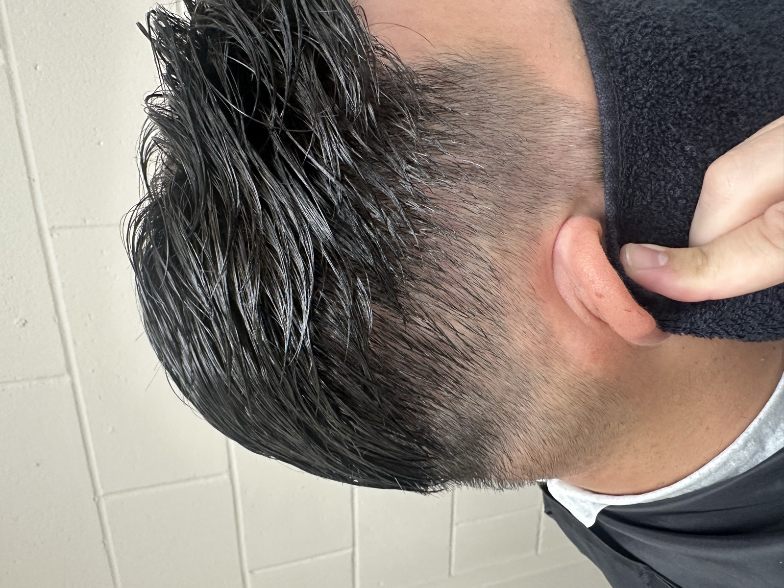 Right side — After