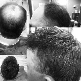 Client photo